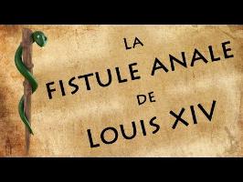 La fistule anale de Louis XIV - Ascl&pios #5